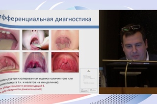 4 Свежие клинические рекомендации по диагностике и лечению острого тонзиллофар ...