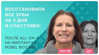 Омоложение без пластики – помог стоматолог и имплантация all-on-4!