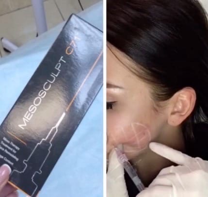 Mesosculpt c71 отзывы фото до и после Наталья Габерман ВКонтакте