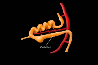 Embryological Rotation of the Midgut