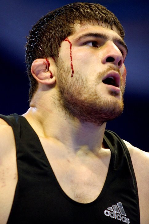 Борцовские уши фото Борцовские уши фото