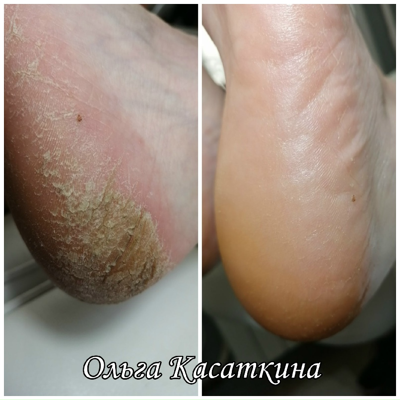 Ольга Касаткина | Березники