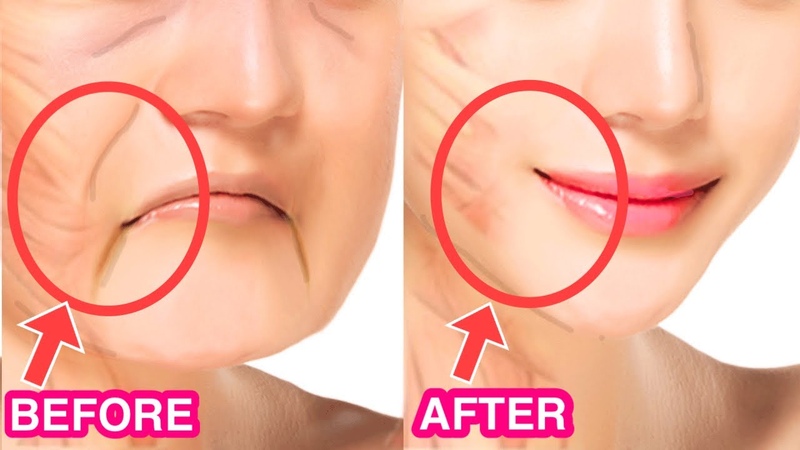 Anti Aging Face Lifting Massage with OIL for Jowls, Laugh Lines, Droopy Eyelids, Glowing