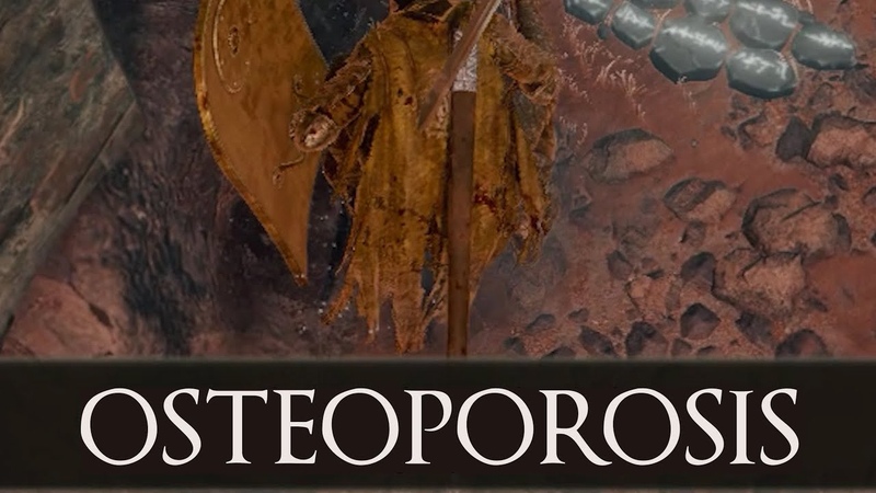 Elden Ring Epic summary OF THE WHOLE GAME, Deep