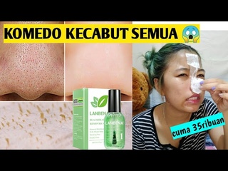 KOMEDO HILANG SEKALI TARIK! LANBENA BLACKHEAD REMOVER MASK || MASKER KOMEDO VIRAL TIK TOK